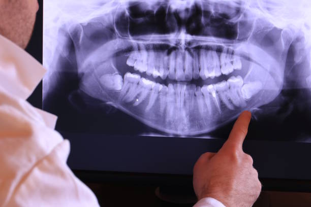 Fast & Reliable Emergency Dental Services in RI