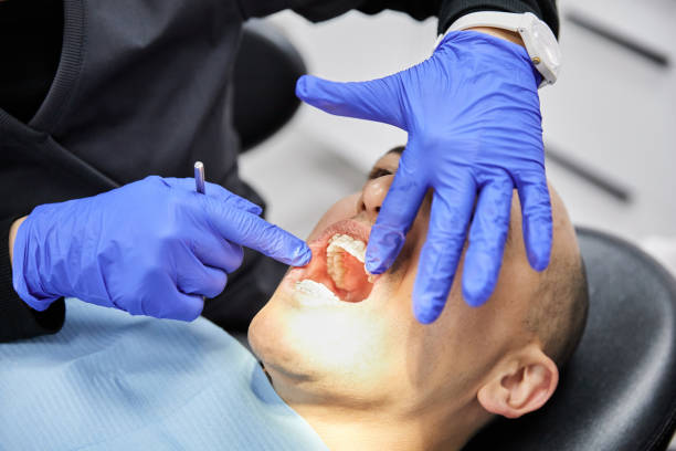 Best Broken or Cracked Tooth Emergency Dentist in Warwick, RI